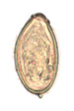 http://upload.wikimedia.org/wikipedia/commons/0/0b/Opisthorchis_viverrini_egg.png